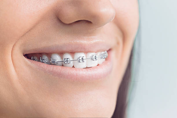 Dental Inlays and Onlays in Decatur, TN
